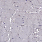 Immunohistochemical staining of human skeletal muscle shows no positivity in myocytes as expected.