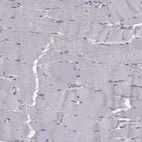Immunohistochemical staining of human skeletal muscle shows no positivity in myocytes as expected.
