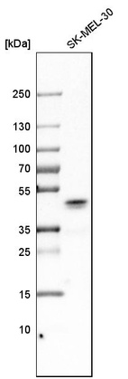 Western blot analysis in human cell line SK-MEL-30.