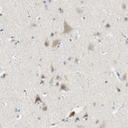Immunohistochemical staining of human cerebral cortex shows moderate cytoplasmic positivity in neurons.