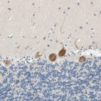 Immunohistochemical staining of human cerebellum shows strong cytoplasmic positivity in Purkinje cells.