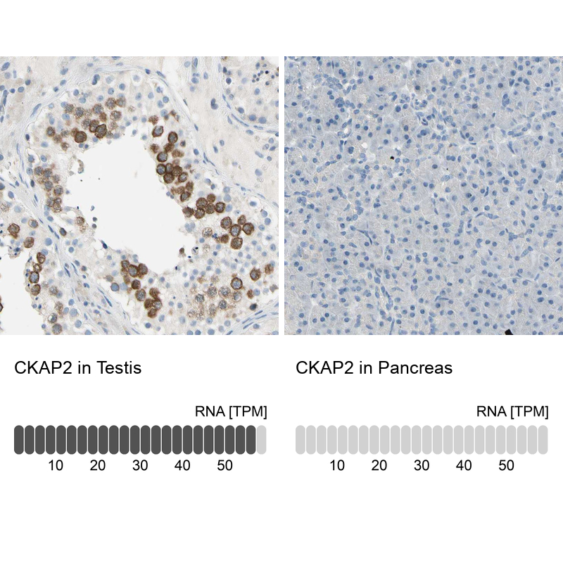Anti-CKAP2 Antibody