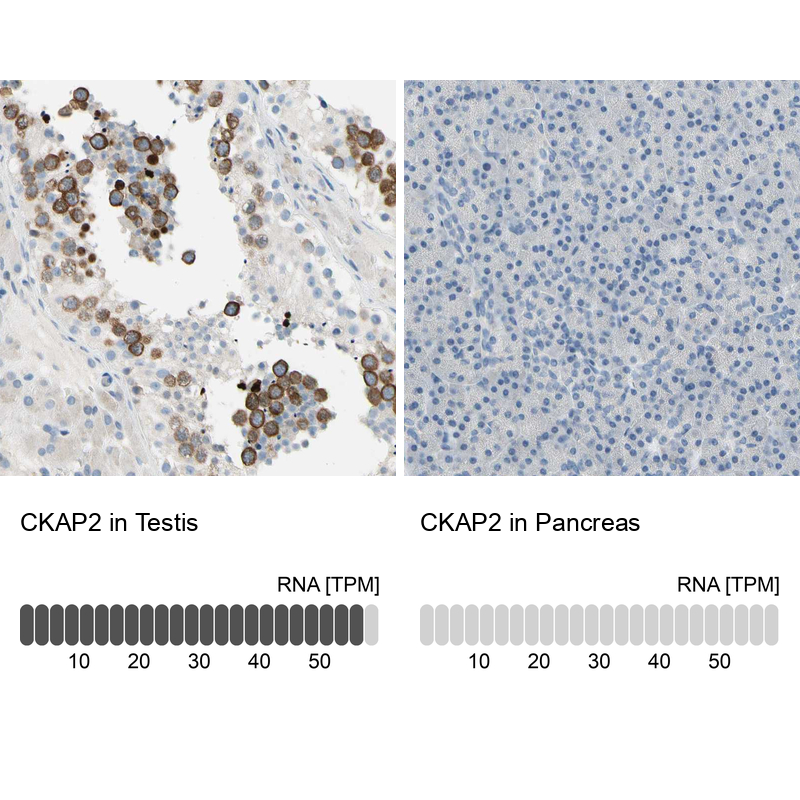 Anti-CKAP2 Antibody