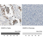 Anti-CKAP2 Antibody