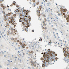 Immunohistochemical staining of human testis shows strong membranous cytoplasmic positivity in cells in seminiferous ducts.