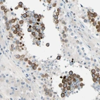 Immunohistochemical staining of human testis shows strong membranous cytoplasmic positivity in cells in seminiferous ducts.