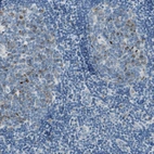 Immunohistochemical staining of human tonsil shows moderate membranous cytoplasmic positivity in germinal center cells.