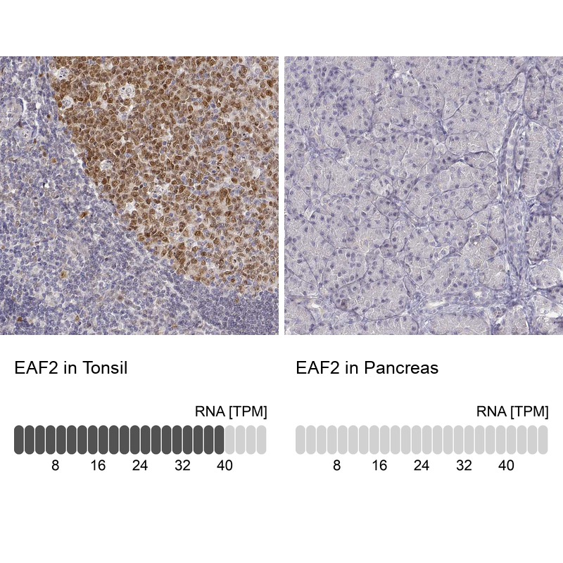 Anti-EAF2 Antibody