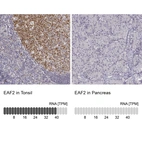 Anti-EAF2 Antibody