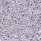 Immunohistochemical staining of human pancreas shows low expression as expected.