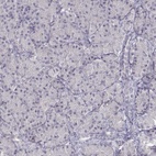 Anti-EAF2 Antibody