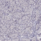 Immunohistochemical staining of human pancreas shows low expression as expected.