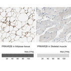 Anti-PRKAR2B Antibody