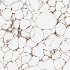Immunohistochemical staining of human adipose tissue shows moderate cytoplasmic positivity in adipocytes.