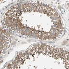 Immunohistochemical staining of human testis shows moderate cytoplasmic positivity in cells in seminiferous ducts.