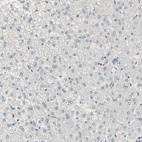 Anti-PRKAR2B Antibody