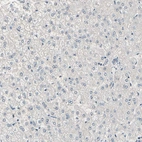 Immunohistochemical staining of human liver shows no positivity in hepatocytes as expected.
