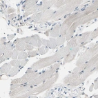Immunohistochemical staining of human skeletal muscle shows no positivity in myocytes as expected.