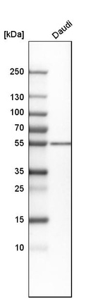 Anti-PRKAR2B Antibody