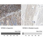 Anti-NFKB2 Antibody