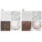 Immunohistochemical staining of human cerebral cortex, kidney, lymph node and testis using Anti-NFKB2 antibody HPA008422 (A) shows similar protein distribution across tissues to independent antibody HPA023900 (B).
