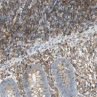 Immunohistochemical staining of human appendix shows high expression.