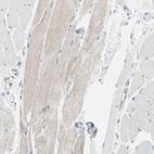 Anti-NFKB2 Antibody