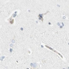 Immunohistochemical staining of human cerebral cortex using Anti-NFKB2 antibody HPA008422.