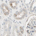 Immunohistochemical staining of human kidney using Anti-NFKB2 antibody HPA008422.