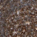 Immunohistochemical staining of human lymph node using Anti-NFKB2 antibody HPA008422.