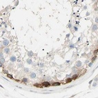 Immunohistochemical staining of human testis using Anti-NFKB2 antibody HPA008422.