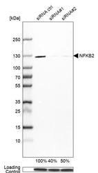 Western blot analysis in A-431 cells transfected with control siRNA, target specific siRNA probe #1 and #2, using Anti-NFKB2 antibody. Remaining relative intensity is presented. Loading control: Anti-GAPDH.