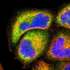 Immunofluorescent staining of human cell line A-431 shows localization to cytosol.