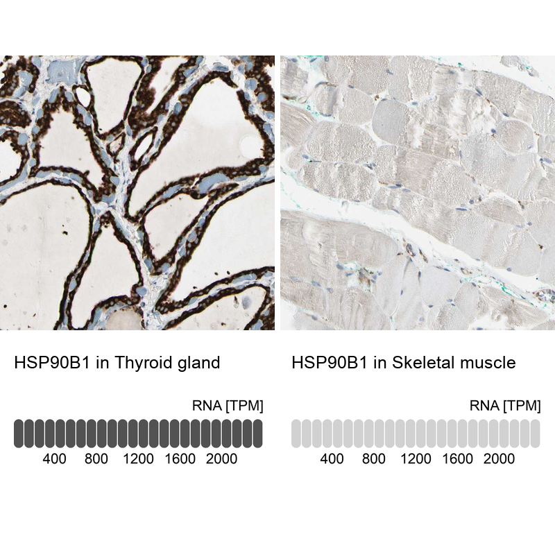 Anti-HSP90B1 Antibody