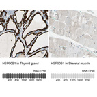 Anti-HSP90B1 Antibody