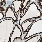 Immunohistochemical staining of human thyroid gland shows strong granular cytoplasmic positivity in glandular cells.