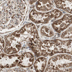 Anti-HSP90B1 Antibody