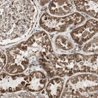 Immunohistochemical staining of human kidney shows strong granular cytoplasmic positivity in cells in tubules.