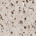 Immunohistochemical staining of human cerebral cortex shows strong granular cytoplasmic positivity in neurons.