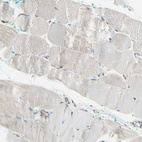 Immunohistochemical staining of human skeletal muscle shows no positivity in myocytes as expected.