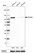 Western blot analysis in U-251MG cells transfected with control siRNA, target specific siRNA probe #1 and #2, using Anti-HSP90B1 antibody. Remaining relative intensity is presented. Loading control: Anti-GAPDH.