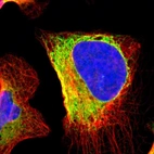 Immunofluorescent staining of human cell line U-2 OS shows localization to endoplasmic reticulum.