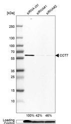 Western blot analysis in Caco-2 cells transfected with control siRNA, target specific siRNA probe #1 and #2, using Anti-CCT7 antibody. Remaining relative intensity is presented. Loading control: Anti-GAPDH.