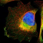 Immunofluorescent staining of human cell line U-2 OS shows localization to plasma membrane & cytosol.