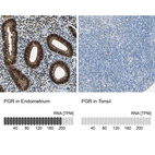 Anti-PGR Antibody