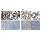 Anti-PGR Antibody