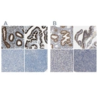 Immunohistochemical staining of human endometrium, fallopian tube, pancreas and tonsil using Anti-PGR antibody HPA008428 (A) shows similar protein distribution across tissues to independent antibody HPA004751 (B).