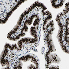 Immunohistochemical staining of human fallopian tube shows strong nuclear positivity in glandular cells.