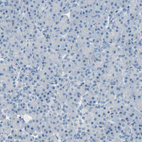 Anti-PGR Antibody