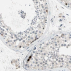 Immunohistochemical staining of human testis shows moderate to strong nuclear positivity in some spermatogonia cells.